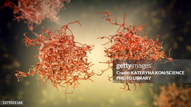 cervical cancer cells, illustration - gynecological examination stock illustrations