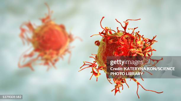 illustrazioni stock, clip art, cartoni animati e icone di tendenza di skin cancer cell, illustration - cancro tumore