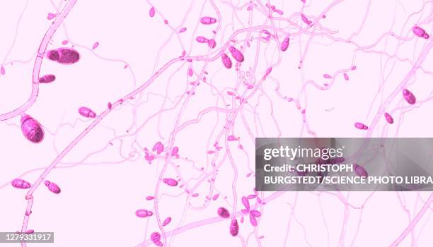 dermatophyte fungus, illustration - onychomycosis stock pictures, royalty-free photos & images