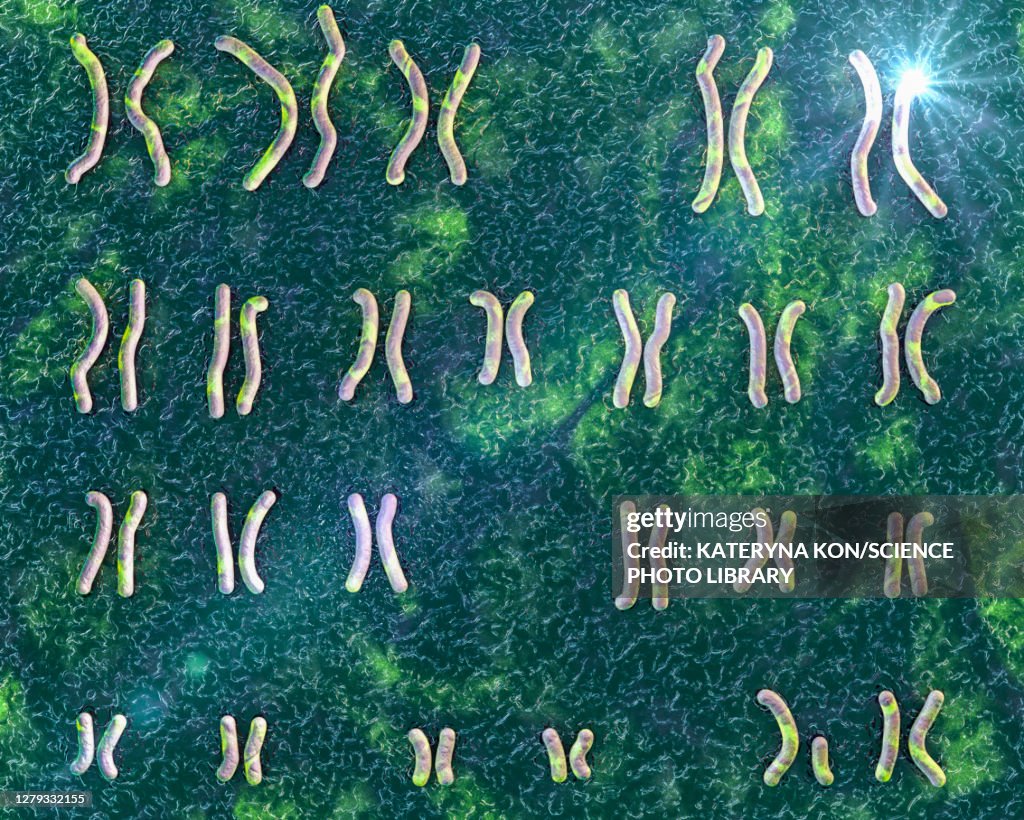 Cri du chat syndrome karyotype, illustration