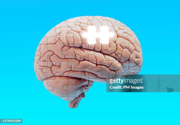brain puzzle missing a piece - demência imagens e fotografias de stock