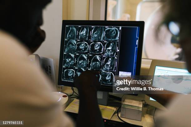 technicians reviewing images on computer screen from mri scan - medical scanning equipment stock pictures, royalty-free photos & images