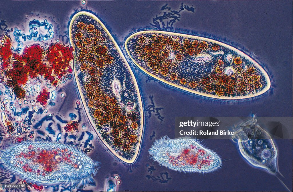 Protozoa composing, fed on colored yeast cells.