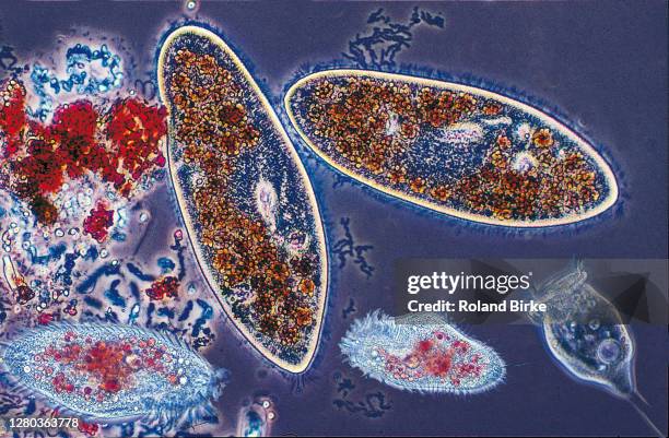 protozoa composing, fed on colored yeast cells. - protozoo fotografías e imágenes de stock