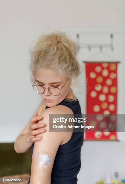 young woman checking insulin pump on her shoulder - insulin pump stockfoto's en -beelden