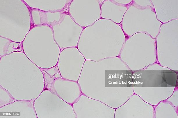 adipose tissue (magnification x 100) a specialized type of connective tissue, showing fat cells (adipocytes), nuclei (peripheral), cytoplasm, and large, clear spaces where fat was stored. - fettgewebezelle stock-fotos und bilder
