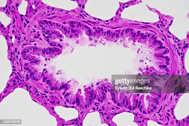 bronchiole in lung (magnification x 100) hematoxylin and eosin stain. cross section showing ciliated epithelium lining, lumen, smooth muscle in wall, and surrounding alveoli. smooth muscle causes bronchoconstriction in asthma. - bronchialbaum stock-fotos und bilder