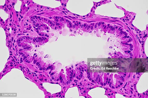 bronchiole in lung (magnification x 100) hematoxylin and eosin stain. cross section showing ciliated epithelium lining, lumen, smooth muscle in wall, and surrounding alveoli. smooth muscle causes bronchoconstriction in asthma. - epitelio imagens e fotografias de stock