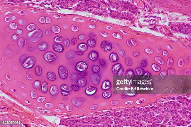 hyaline cartilage from a bronchus in the lungs, (magnification x 100) showing chondrocytes (cartilage cells), lacuna, matrix and perichondrium - hyalien kraakbeen stockfoto's en -beelden