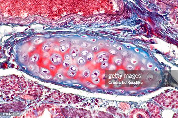 hyaline cartilage, lung, (magnification x 100) masson stain. plate of cartilage in a bronchus wall. showing chondrocytes (cartilage cells), matrix, lacunae, and perichondrium - hyalien kraakbeen stockfoto's en -beelden