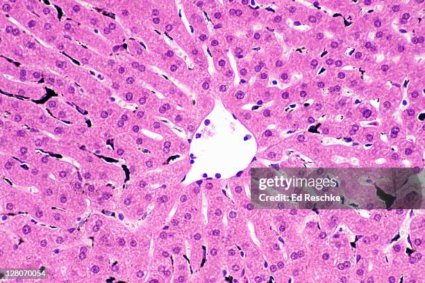 phagocytic cells (kupffer cells) stained with carbon in liver, (magnification x100). kupffer cells (black) that phagocytosed carbon particles, central vein, sinusoids (channels), and hepatic cells. - phagocytosis stock pictures, royalty-free photos & images