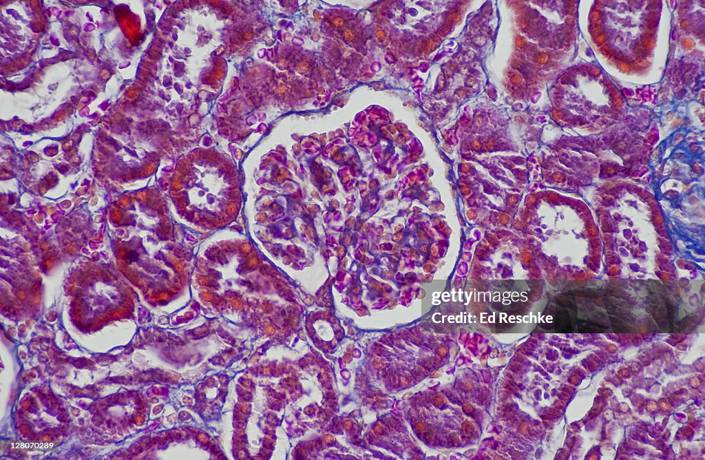 Glomerulus and Glomerular (Bowman's) Capsule, Human Renal Tubules, Kidney (Magnification x100). Mallory stain. Glomerulus (capillaries and red blood cells), Glomerular Capsule, and surrounding renal tubules.