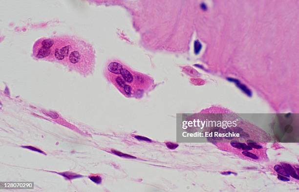 Multinucleated Tissue Multinucleate Photos and Premium High Res Pictures - Getty Images