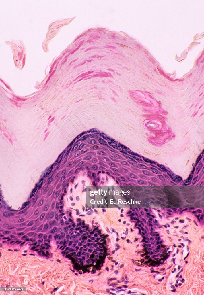 HISTOLOGY (Microanatomy) of the EPIDERMIS--LAYERS OF THE EPIDERMIS and SHEDDING of SQUAMOUS CELLS (Desquamation) 200X