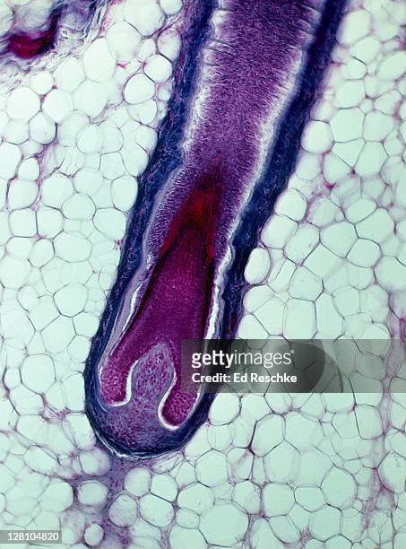 hair follicle, hair bulb, and hair papilla, human scalp, 25x at 35mm. growth takes place at the base of the hair follicle. adipose tissue surrounds the hair bulb. - light micrograph stock-fotos und bilder
