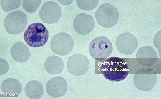 malarial parasites infecting three red blood cells, plasmodium vivax, 500x at 35mm. three infected cells are clearly shown, the ring stage is in the center. chills and fever of malaria are correlated with the bursting of the rbcs. - malaria stockfoto's en -beelden