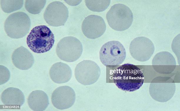 malarial parasites infecting three red blood cells, plasmodium vivax, 500x at 35mm. three infected cells are clearly shown, the ring stage is in the center. chills and fever of malaria are correlated with the bursting of the rbcs. - malaria parasite stock pictures, royalty-free photos & images
