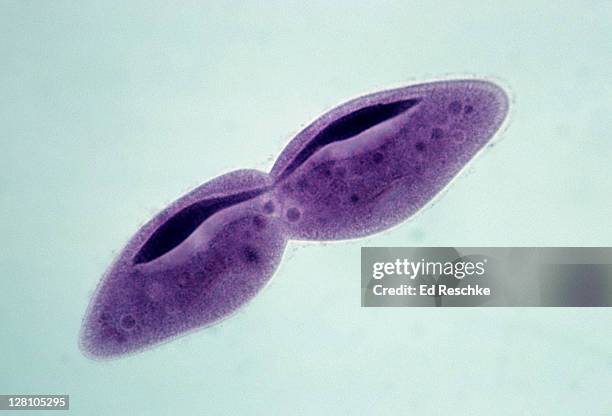 paramecium. fission, cell and macronucleus dividing, 100x at 35mm. this is asexual reproduction. - división fotografías e imágenes de stock