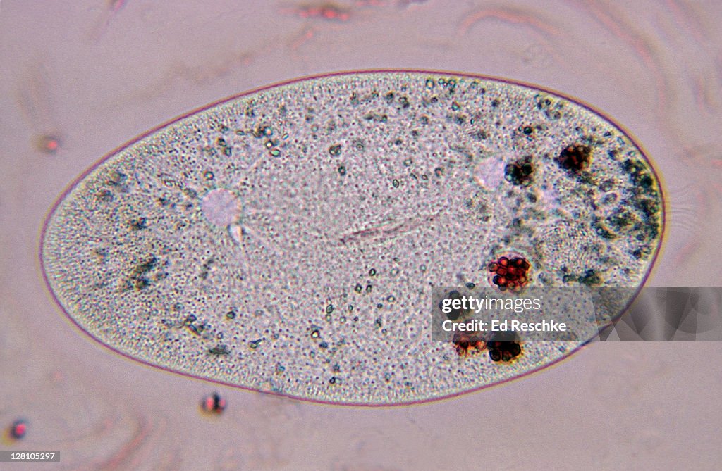 Paramecium, food vacuoles and contractile vacuoles, 250X at 35mm. The food vacuoles contain stained yeast cells which were ingested. Also shows two contractile vacuoles and cilia. Ciliated protozoan.