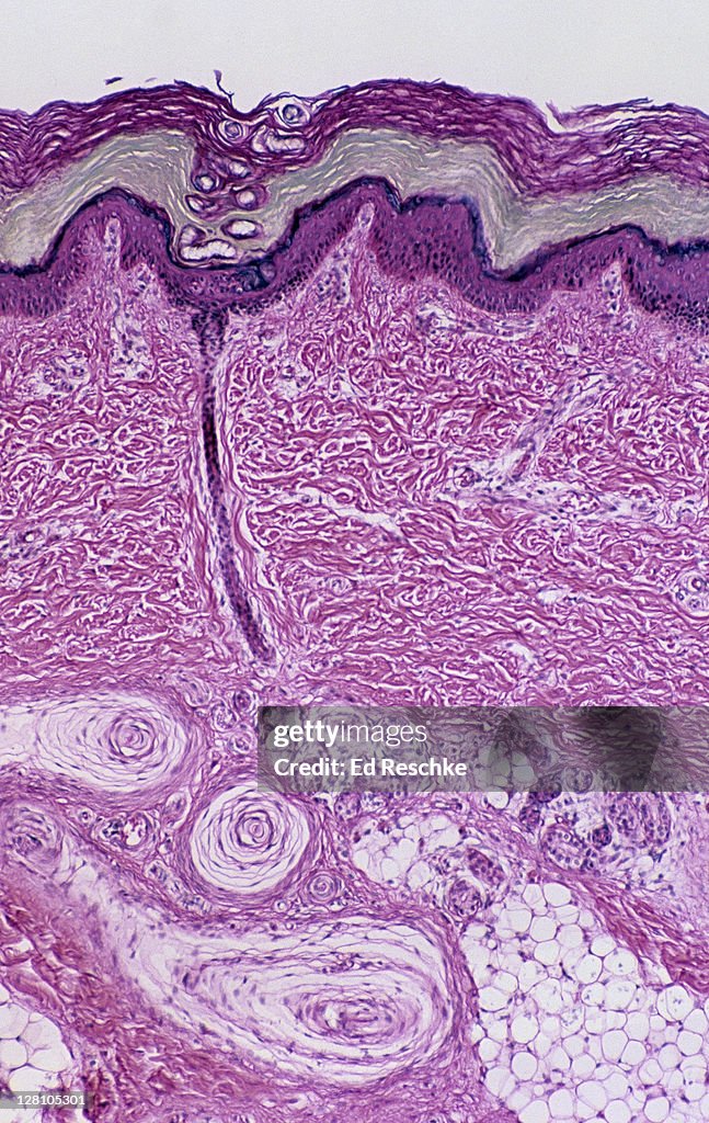 Sensory Receptors (Pacinian Corpuscles), Sweat Glands and ducts, Thick Skin, Human, 25X at 35mm. Pacinian Corpuscles are deep pressure receptors. The sweat gland ducts is seen in the epidermis and dermis.