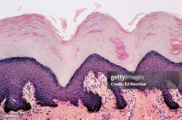 skin. desquamation (sloughing of cells) from the epidermis, thick skin, human, 100x at 35mm. shows: epidermal layers (stratum: corneum, granulosum, spinosum, basale), dermis, sweat gland ducts and desquamating cells sloughing off the surface. - microfotografia immunofluorescente foto e immagini stock