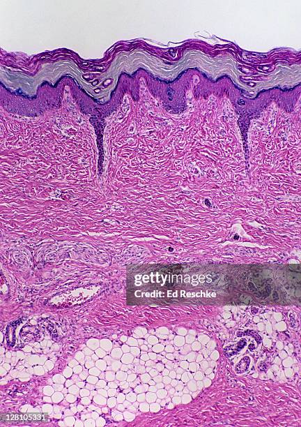 skin. epidermis, dermis, subcutaneous layer, thick skin, 25x at 35mm. shows: layers of epidermis, dermis, subcutaneous layer, sweat glands and ducts, adipose tissue. human. - human tissue stock-fotos und bilder