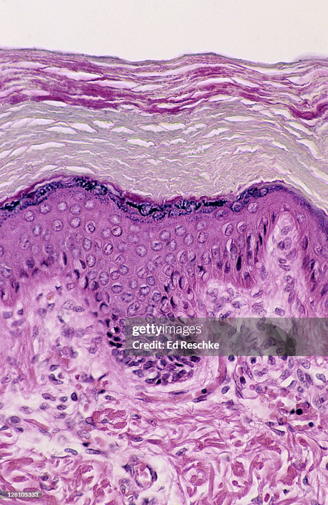 Skin. Layers of the Epidermis, Human, Thick Skin, 100X at 35mm. Shows Epidermal Layers--Stratum: basale, spinosum, granulosum, lucidum, corneum, and dermis.