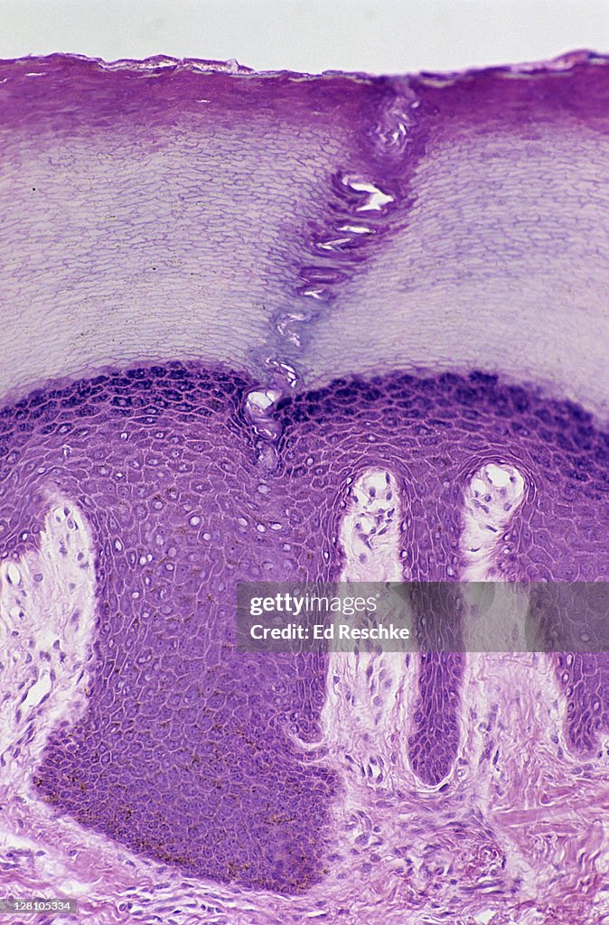 Skin. Layers of the Epidermis, Human, Thick, 50X at 35mm. Layers of the Epidermis - Stratum: corneum, lucidum, granulosum, spinosum and basale. Also, shows dermis and sweat gland duct.