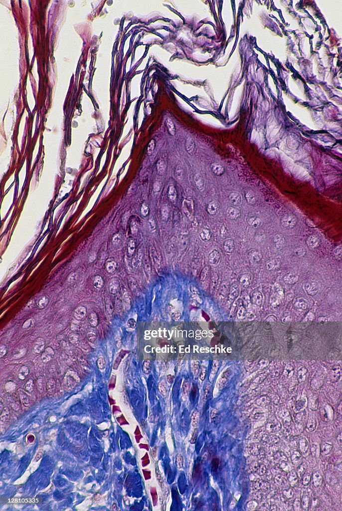 Capillary Stasis Skin Scalp Human Capillaries In Dermis 100x At 35mm Shows Epidermis ...