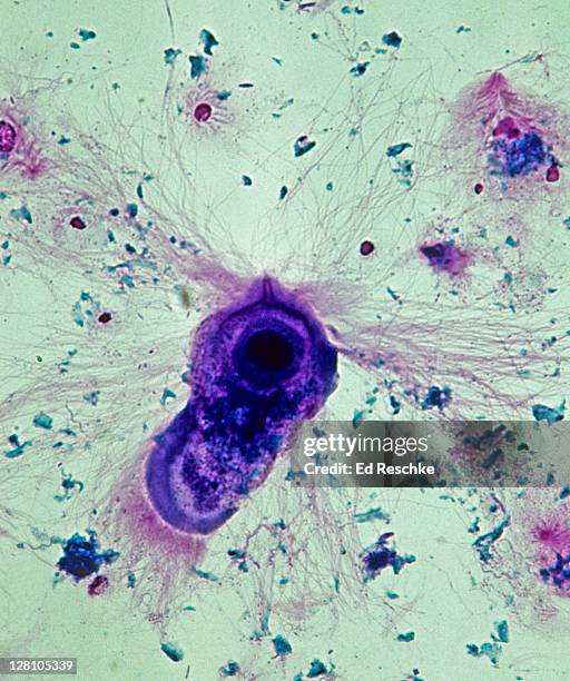 symbiosis; mutualism, trichonympha, termite gut, 100x at 35mm. trichonympha is a flagellated protozoan that lives in the termite intestine. it digests cellulose in the wood releasing sugars for the termites nutrition. shows flagellae and nucleus. - trichonympha stockfoto's en -beelden