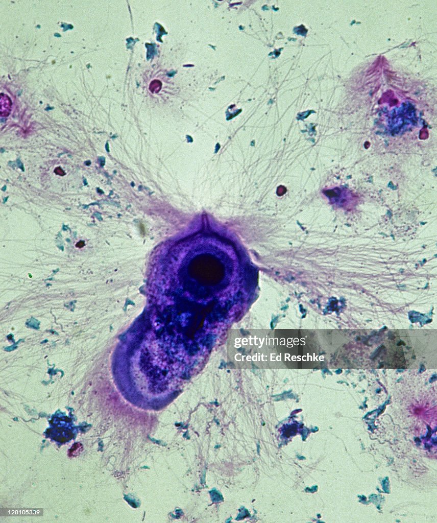 Symbiosis; Mutualism, Trichonympha, Termite Gut, 100X at 35mm. Trichonympha is a flagellated protozoan that lives in the termite intestine. It digests cellulose in the wood releasing sugars for the termites nutrition. Shows flagellae and nucleus.