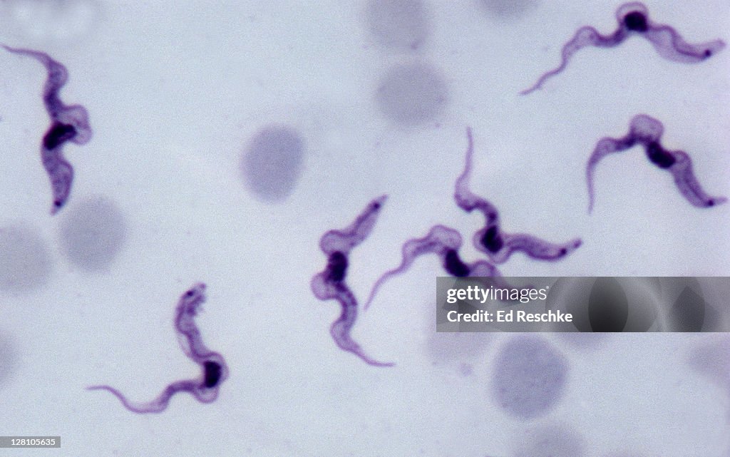 Trypanosomes, cause of African Sleeping Sickness, Trypanosoma gambiense, 600X at 35mm. Blood smear. Protozoan parasite that shows a nucleus, undulating membrane and flagellum. Transmitted by the tsetse fly.