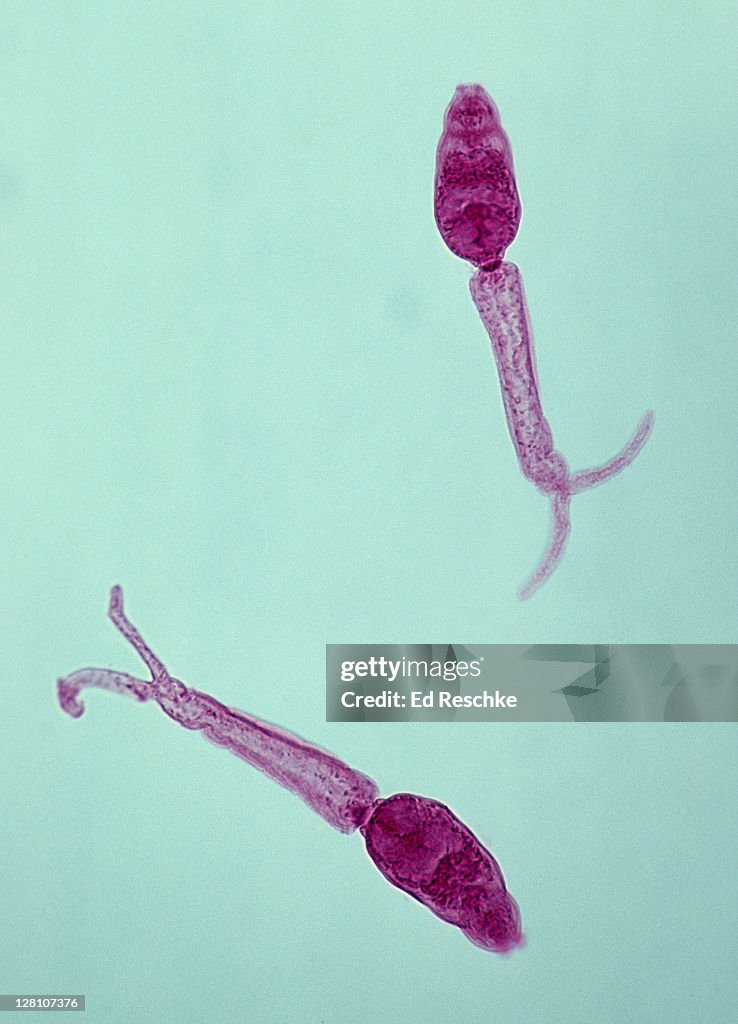 Cercariae, Blood Fluke (Schistosoma mansoni), 50X at 35mm. Intermediate swimming stage in the life cycle of the fluke. Leaves the snail and attaches to human skin and enters the body. Flatworm.