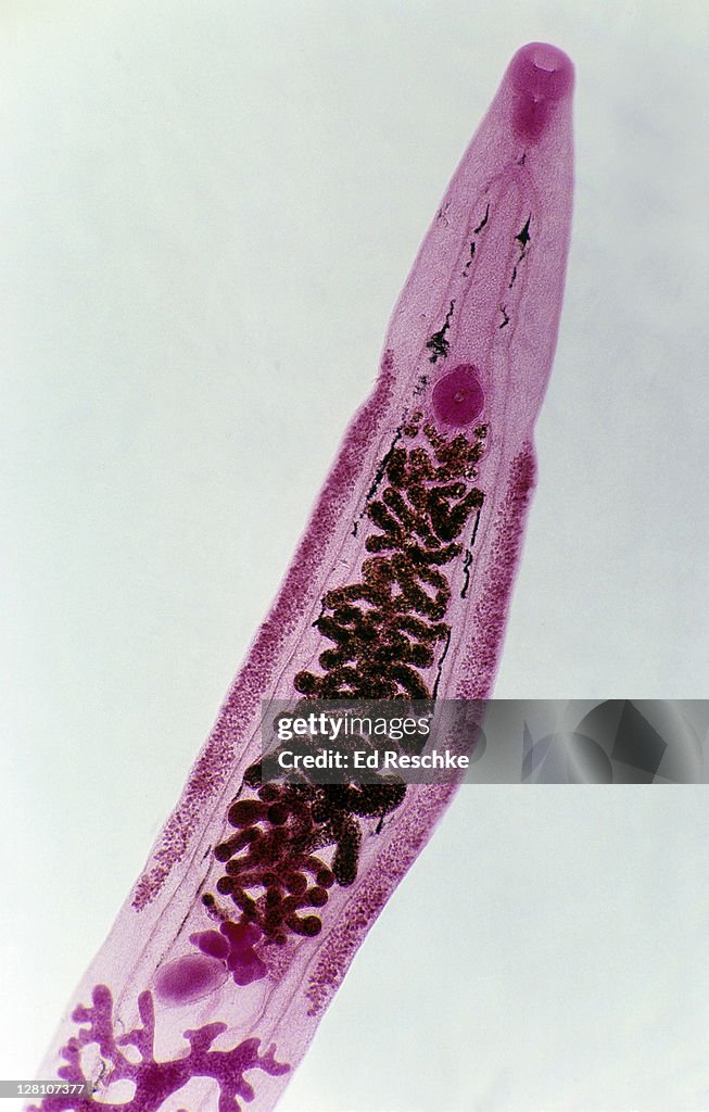 Chinese Liver Fluke (Opisthorchis sinensis), 10X at 35mm. Shows: oral sucker, ventral sucker, intestine, uterus, testes, ovaries, seminal receptacle. Flatworm, hermaphrodite.