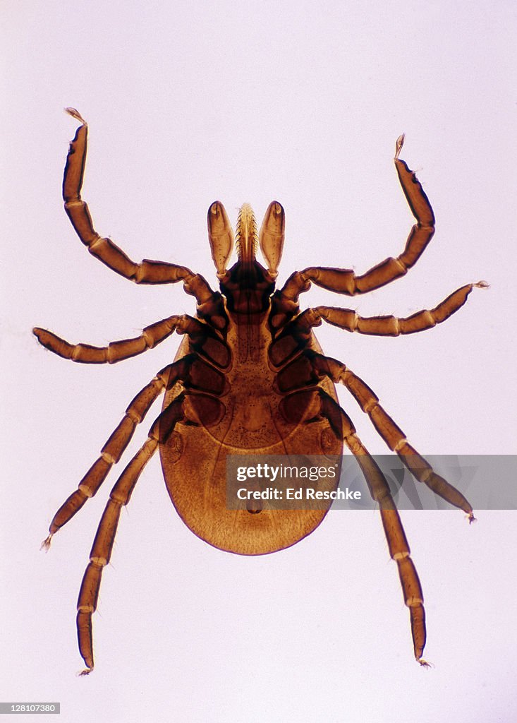 Deer Tick, Adult female. Ixodes dammini. Lyme Disease, 5X at 35mm. The head has a piercing organ called the hypostome. The nymph stage is the most likely stage to infect humans.