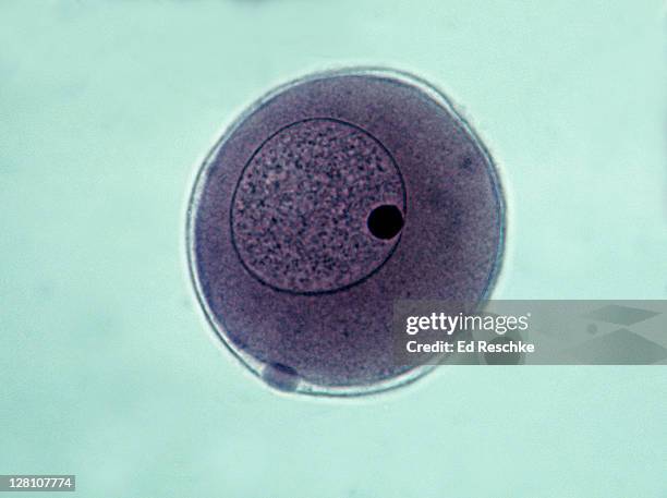 starfish embryology. fertilized egg, fertilization membrane and polar body, 100x at 35mm. early starfish development. shows: fertilized egg, fertilization membrane, polar body, nucleus, nucleolus, chromatin and cytoplasm. - citoplasma imagens e fotografias de stock