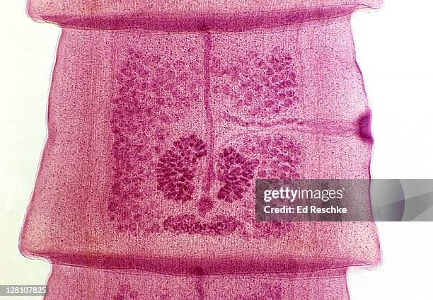 mature proglottid, dog tapeworm (taenia pisiformis), 10x at 35mm. shows: testes, ovary, uterus, yolk gland, shell gland, vagina, sperm duct and genital pore. flatworm (phylum platyhelmintes), hermaphrodite. - dog tapeworm stock pictures, royalty-free photos & images