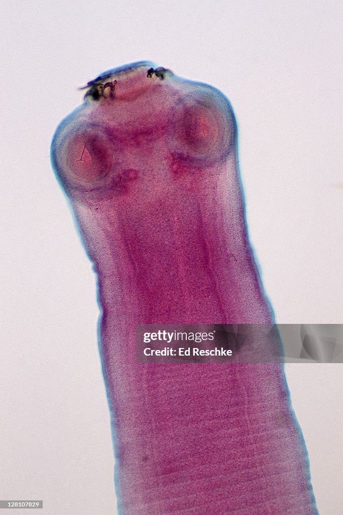 Tapeworm Scolex, Taenia sp., 10X at 35mm. Shows: scolex, suckers, hooks, cuticle, and immature segments. Flatworm (Platyhelminthes), hermaphrodite.