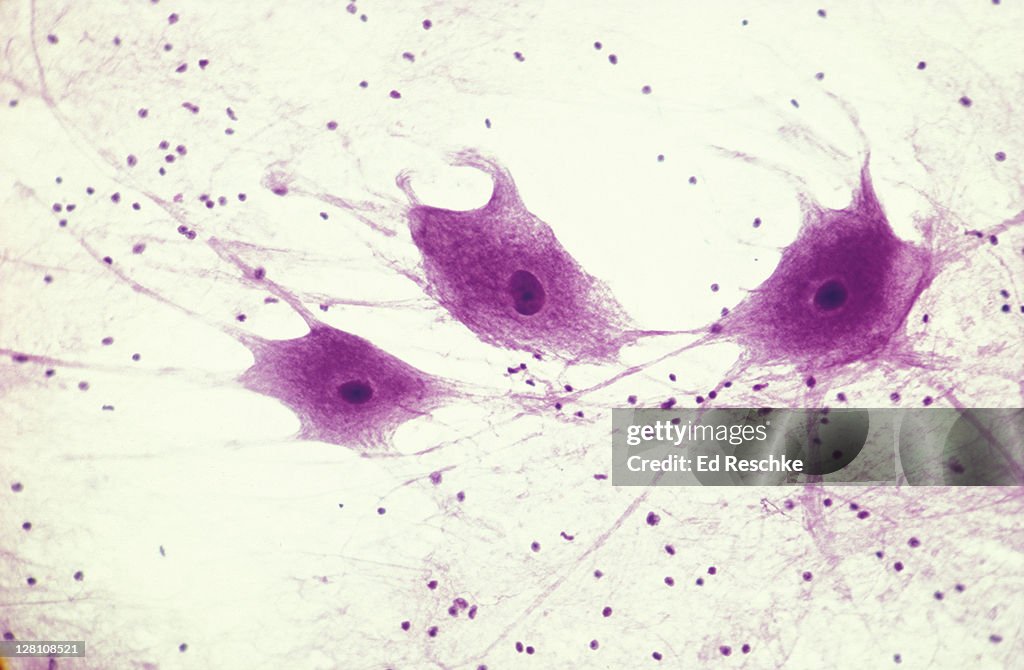 Photomicrograph of nerve cells showing axons and dendrites; 50X