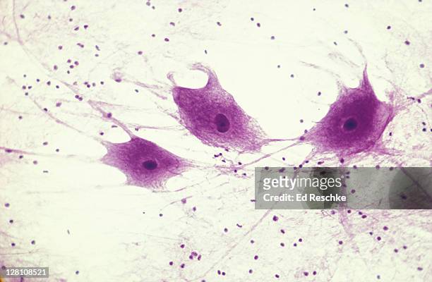 photomicrograph of nerve cells showing axons and dendrites; 50x - 軸索 ストックフォトと画像