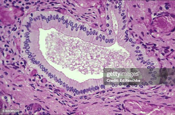 photomicrograph of simple columnar epithelium of pancreatic duct. - epitelio imagens e fotografias de stock