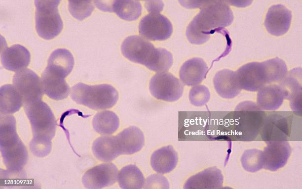 trypanosoma cruzi, cause of chagas disease, blood smear, 400x at 35mm. protozoan parasite with an undulating membrane, flagellum and nucleus. common in south america. transmitted by triatomid bugs which suck blood. - parasitic ストックフォトと画像