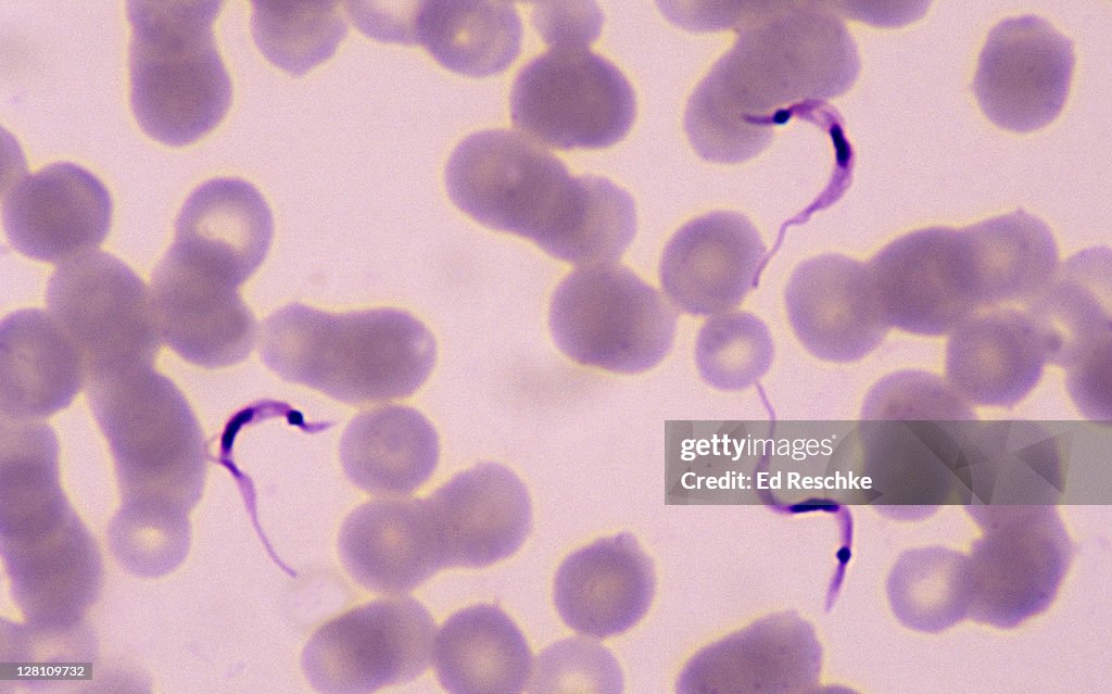 Trypanosoma cruzi, cause of Chagas Disease, Blood Smear, 400X at 35mm. Protozoan parasite with an undulating membrane, flagellum and nucleus. Common in South America. Transmitted by Triatomid bugs which suck blood.