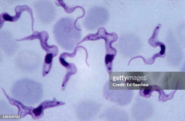 trypanosomes, cause of african sleeping sickness, trypanosoma gambiense, 600x at 35mm. blood smear. protozoan parasite that shows a nucleus, undulating membrane and flagellum. transmitted by the tsetse fly. - tsetse fly fotografías e imágenes de stock
