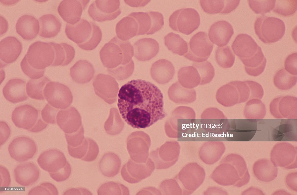 EOSINOPHIL (WBC) BILOBED NUCLEUS & REDDISH CYTOPLAS- MIC GRANULES. 400X