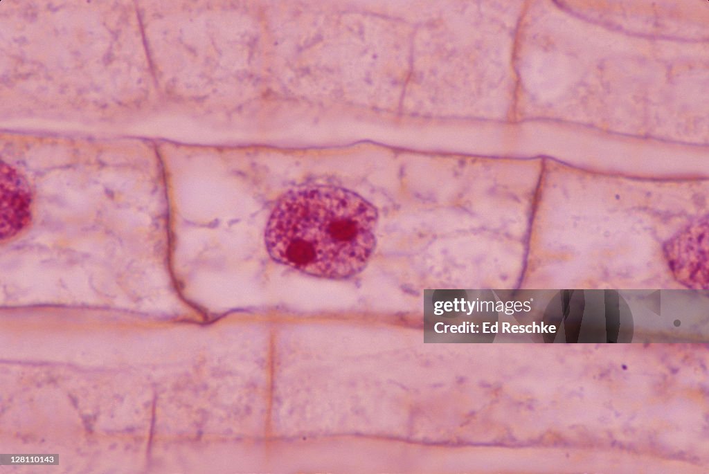 Interphase Magnification Interphase Mitosis Onion Root Tip400x High-Res Stock Photo - Getty Images