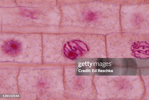 Early Prophase Mitosis Onion Root Tip 400x High-Res Stock Photo - Getty Images