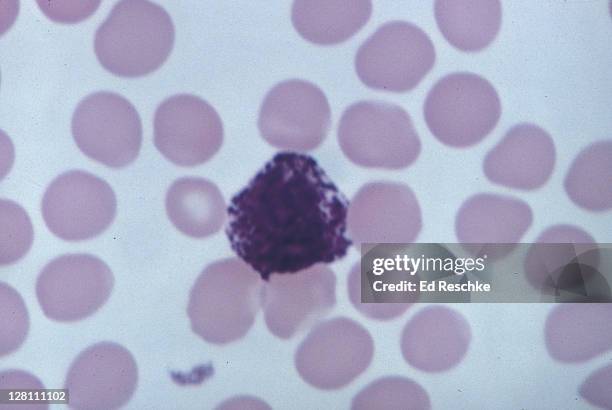 Basofili 155 Basophil Stock Photos, High-Res Pictures, and Images - Getty Images