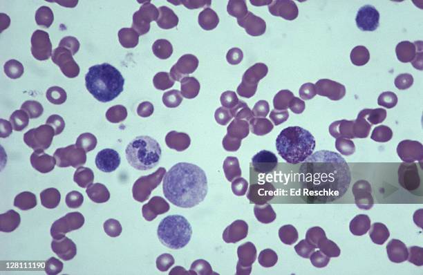 bone marrow of human. many immature cells 1000x - beenmerg bot stockfoto's en -beelden