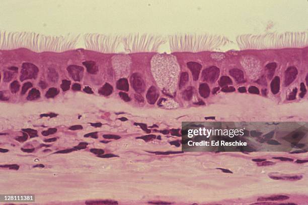 pseudostratified ciliated columnar epithelium (trachea). cilia, goblet cells. 100x - epitelio imagens e fotografias de stock